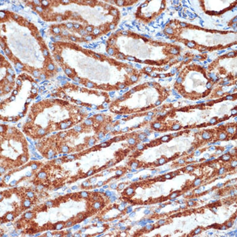 Immunohistochemistry - Anti-NDUFB8 Antibody [ARC2259] (A307077) - Antibodies.com