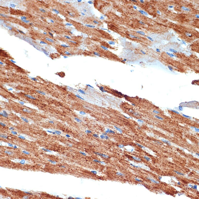 Immunohistochemistry - Anti-NDUFB8 Antibody [ARC2259] (A307077) - Antibodies.com