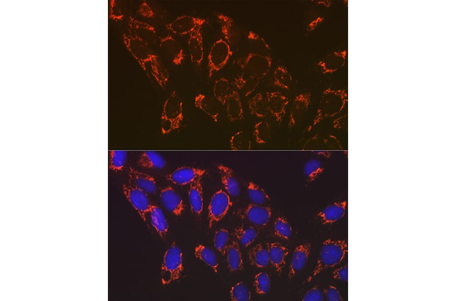 Immunofluorescence - Anti-NDUFB8 Antibody [ARC2259] (A307077) - Antibodies.com