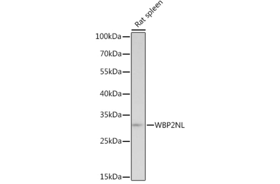 Western Blot - Anti-WBP2NL Antibody (A307078) - Antibodies.com