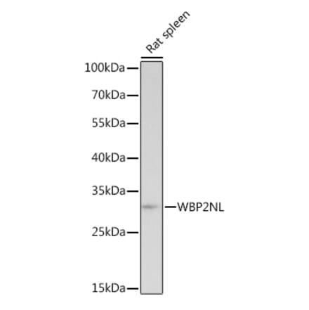 Western Blot - Anti-WBP2NL Antibody (A307078) - Antibodies.com