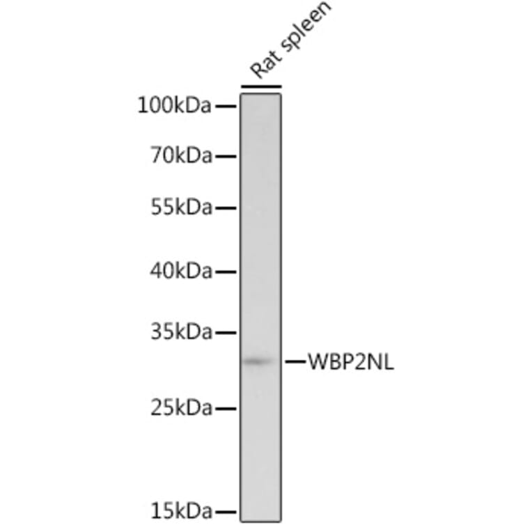 Western Blot - Anti-WBP2NL Antibody (A307078) - Antibodies.com