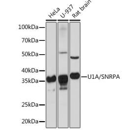 Western Blot - Anti-U1A Antibody [ARC0823] (A307079) - Antibodies.com