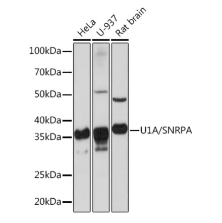 Western Blot - Anti-U1A Antibody [ARC0823] (A307079) - Antibodies.com