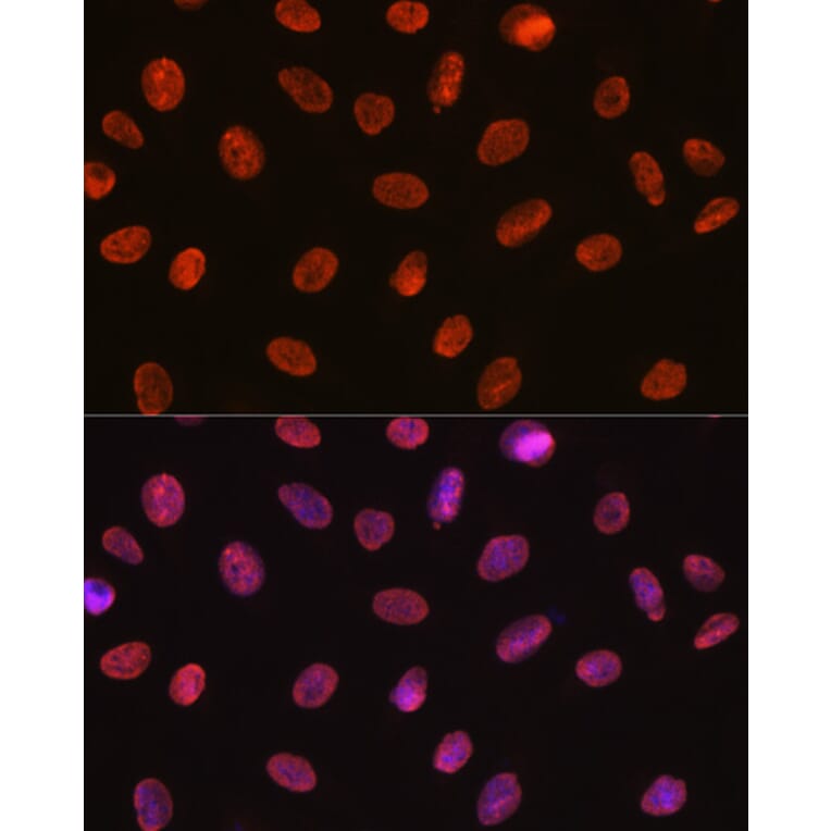 Immunofluorescence - Anti-U1A Antibody [ARC0823] (A307079) - Antibodies.com