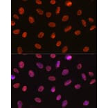 Immunofluorescence - Anti-U1A Antibody [ARC0823] (A307079) - Antibodies.com