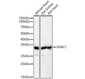 Western Blot - Anti-VDAC1/Porin Antibody (A307082) - Antibodies.com