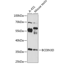 Western Blot - Anti-BCDIN3D Antibody (A307084) - Antibodies.com