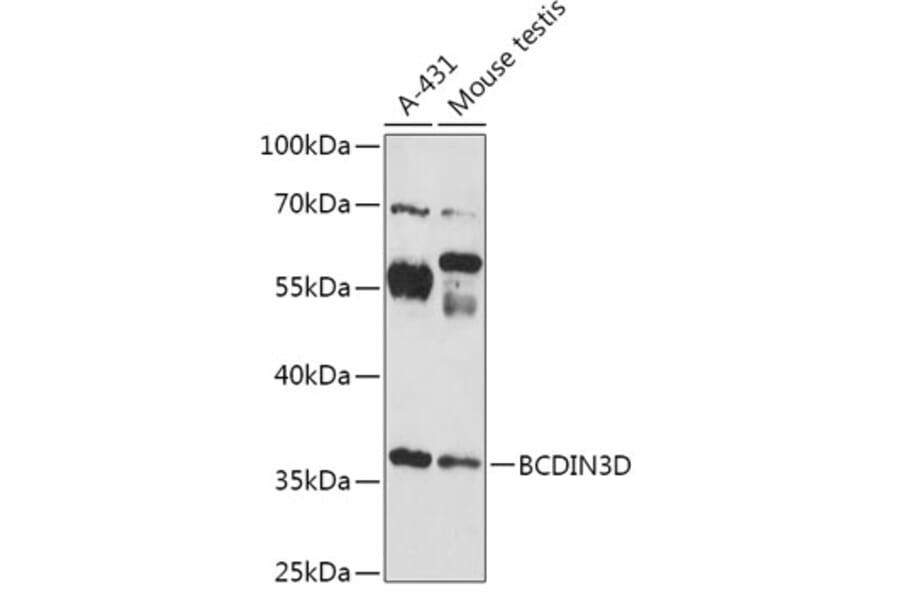 Western Blot - Anti-BCDIN3D Antibody (A307084) - Antibodies.com
