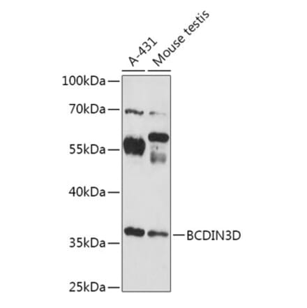 Western Blot - Anti-BCDIN3D Antibody (A307084) - Antibodies.com