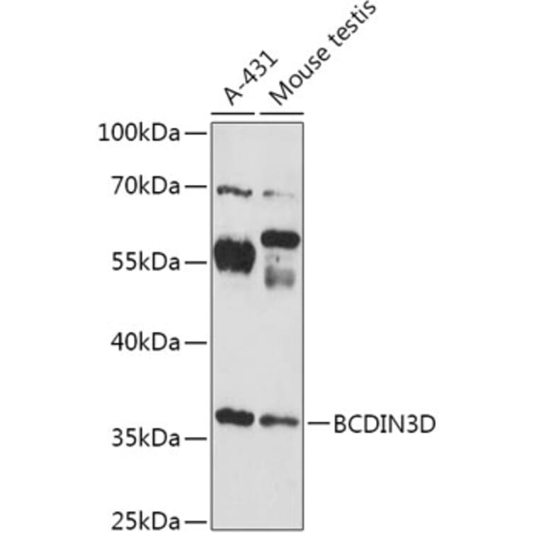 Western Blot - Anti-BCDIN3D Antibody (A307084) - Antibodies.com