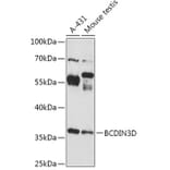 Western Blot - Anti-BCDIN3D Antibody (A307084) - Antibodies.com