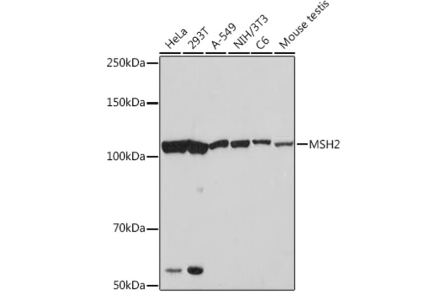 Western Blot - Anti-MSH2 Antibody [ARC1285] (A307085) - Antibodies.com