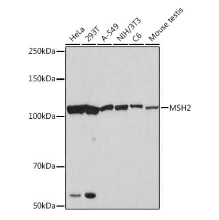 Western Blot - Anti-MSH2 Antibody [ARC1285] (A307085) - Antibodies.com