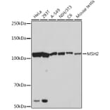 Western Blot - Anti-MSH2 Antibody [ARC1285] (A307085) - Antibodies.com