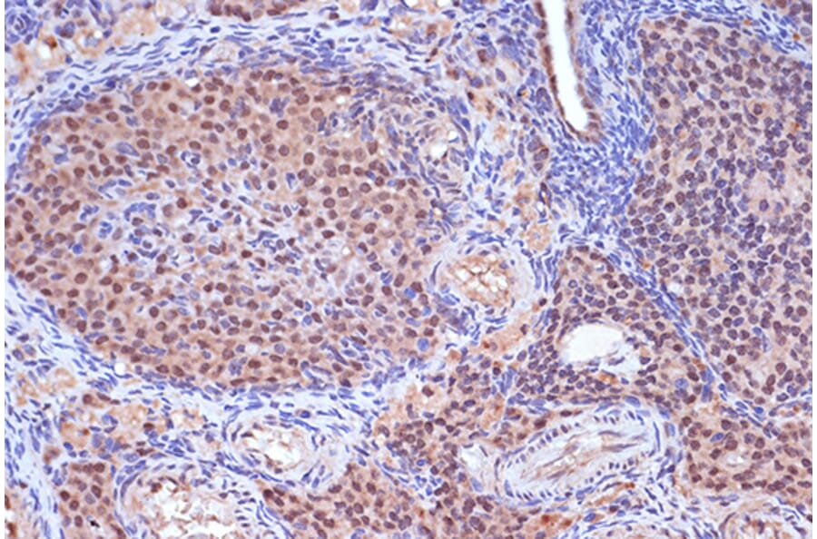 Immunohistochemistry - Anti-MSH2 Antibody [ARC1285] (A307085) - Antibodies.com