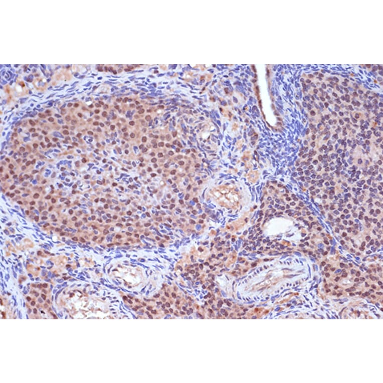 Immunohistochemistry - Anti-MSH2 Antibody [ARC1285] (A307085) - Antibodies.com