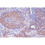 Immunohistochemistry - Anti-MSH2 Antibody [ARC1285] (A307085) - Antibodies.com