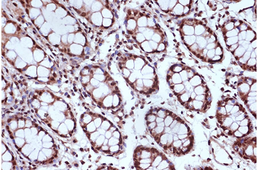 Immunohistochemistry - Anti-MSH2 Antibody [ARC1285] (A307085) - Antibodies.com