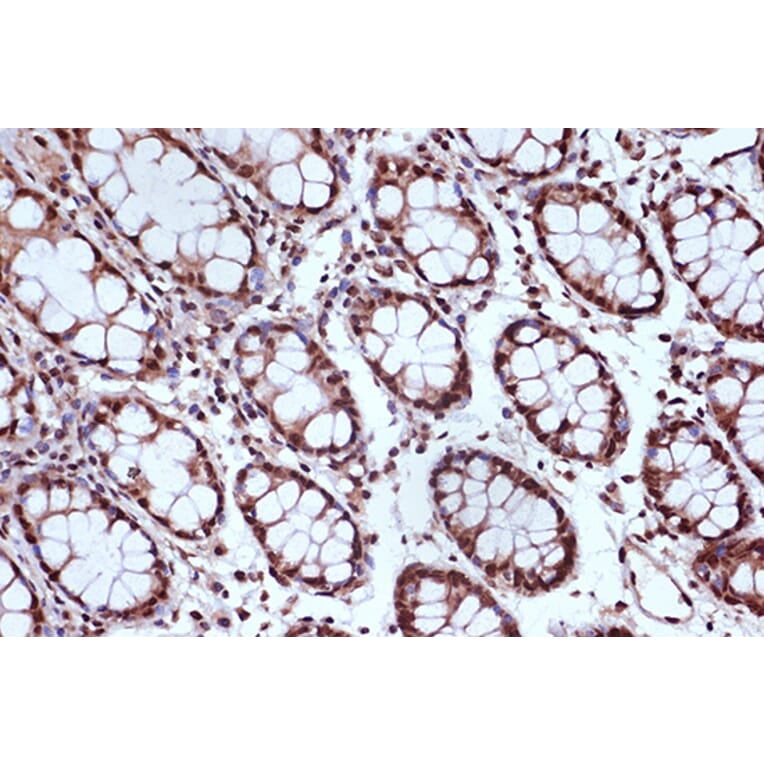 Immunohistochemistry - Anti-MSH2 Antibody [ARC1285] (A307085) - Antibodies.com