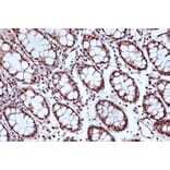 Immunohistochemistry - Anti-MSH2 Antibody [ARC1285] (A307085) - Antibodies.com