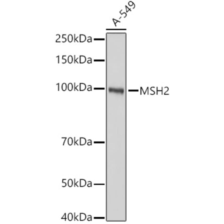 Western Blot - Anti-MSH2 Antibody (A307086) - Antibodies.com