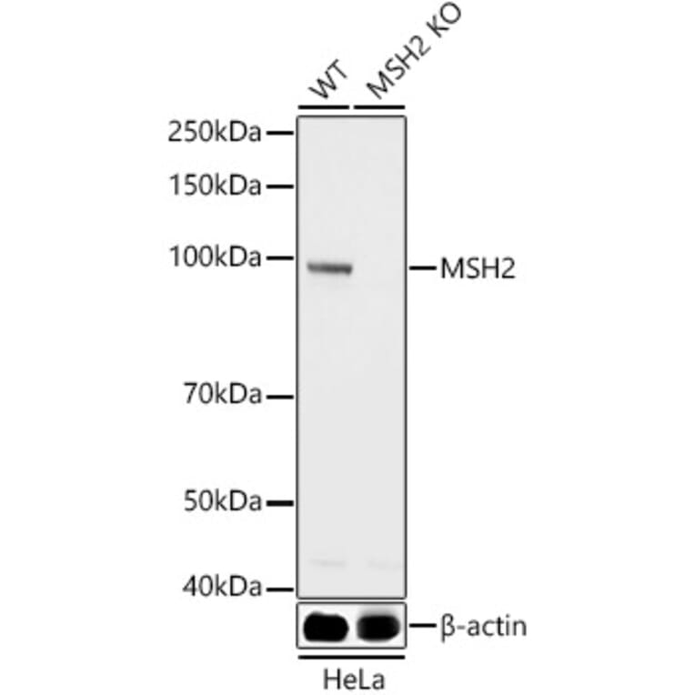 Western Blot - Anti-MSH2 Antibody (A307086) - Antibodies.com