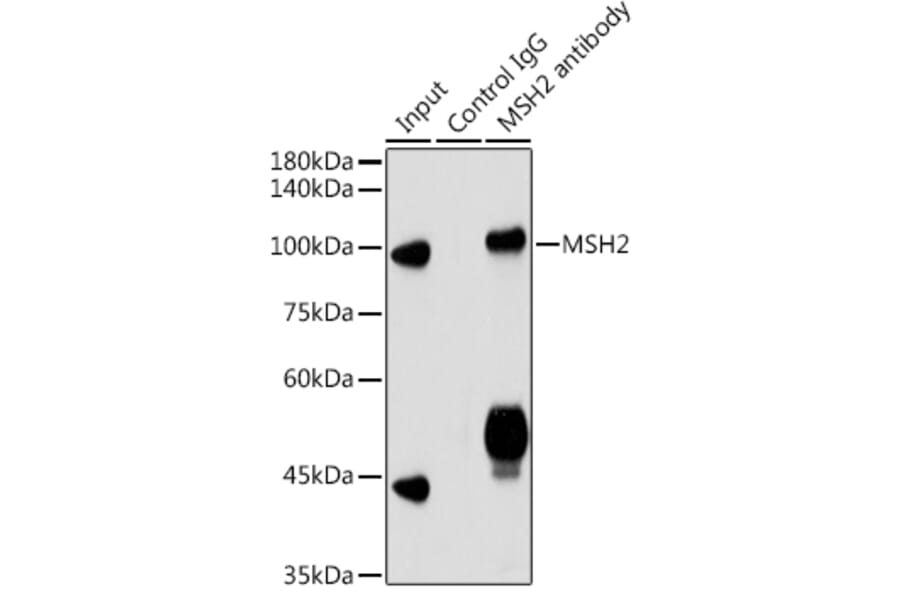 Western Blot - Anti-MSH2 Antibody (A307086) - Antibodies.com