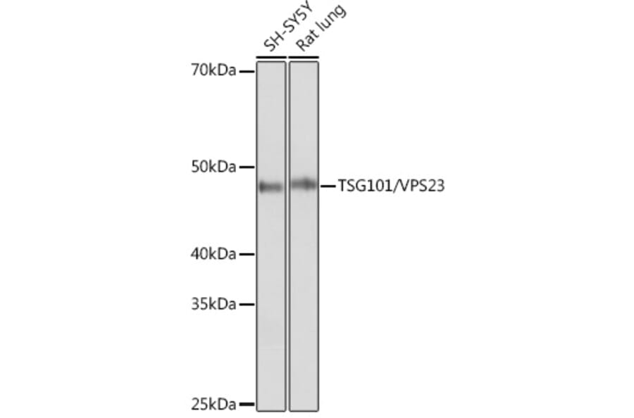 Western Blot - Anti-TSG101 Antibody [ARC0853] (A307087) - Antibodies.com