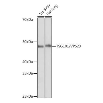 Western Blot - Anti-TSG101 Antibody [ARC0853] (A307087) - Antibodies.com