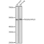 Western Blot - Anti-TSG101 Antibody [ARC0853] (A307087) - Antibodies.com