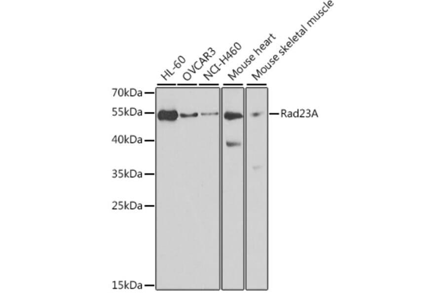 Western Blot - Anti-hHR23A Antibody (A307088) - Antibodies.com