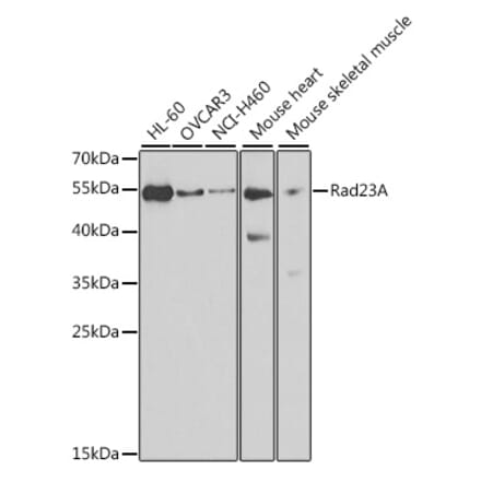 Western Blot - Anti-hHR23A Antibody (A307088) - Antibodies.com