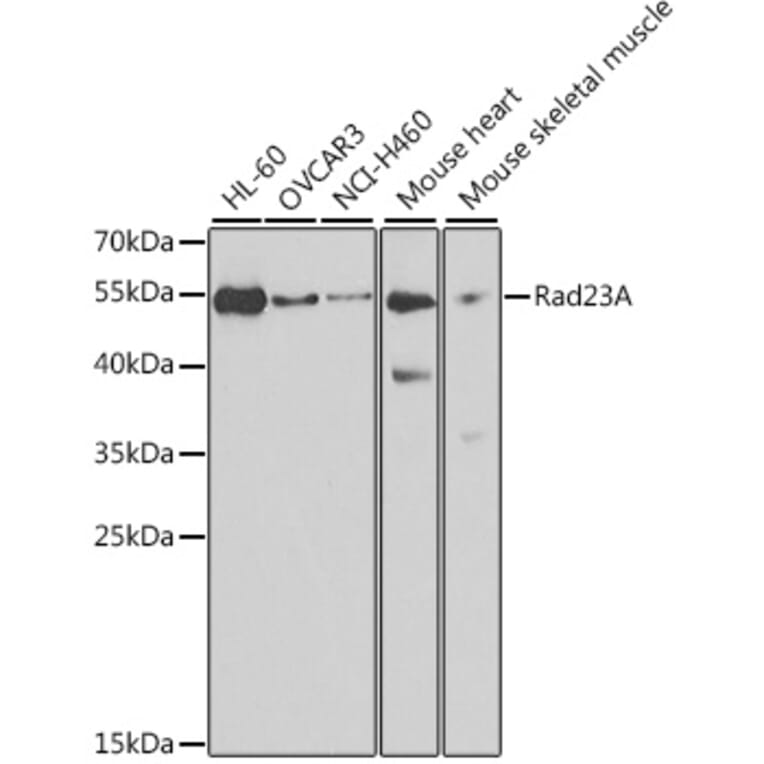 Western Blot - Anti-hHR23A Antibody (A307088) - Antibodies.com