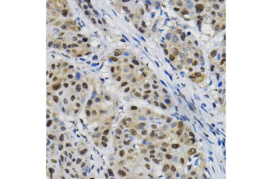 Immunohistochemistry - Anti-DNAJC17 Antibody (A307090) - Antibodies.com