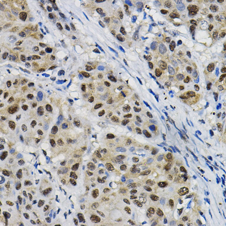 Immunohistochemistry - Anti-DNAJC17 Antibody (A307090) - Antibodies.com