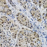 Immunohistochemistry - Anti-DNAJC17 Antibody (A307090) - Antibodies.com