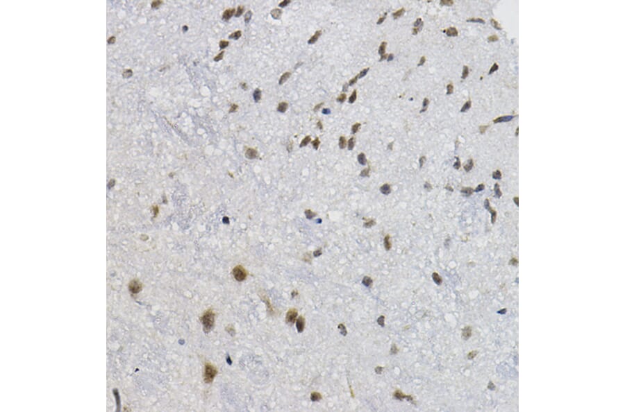 Immunohistochemistry - Anti-DNAJC17 Antibody (A307090) - Antibodies.com