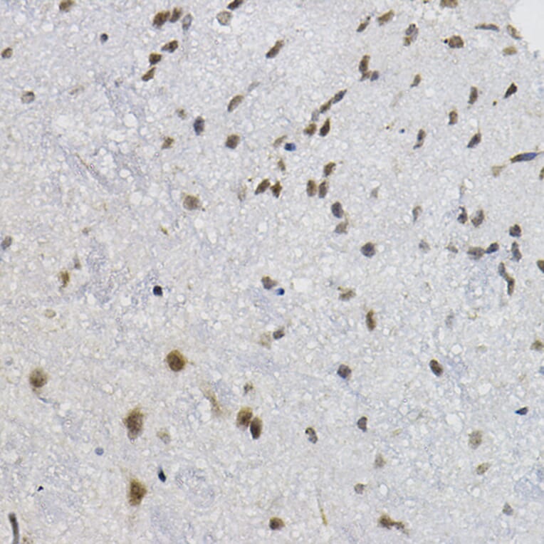 Immunohistochemistry - Anti-DNAJC17 Antibody (A307090) - Antibodies.com