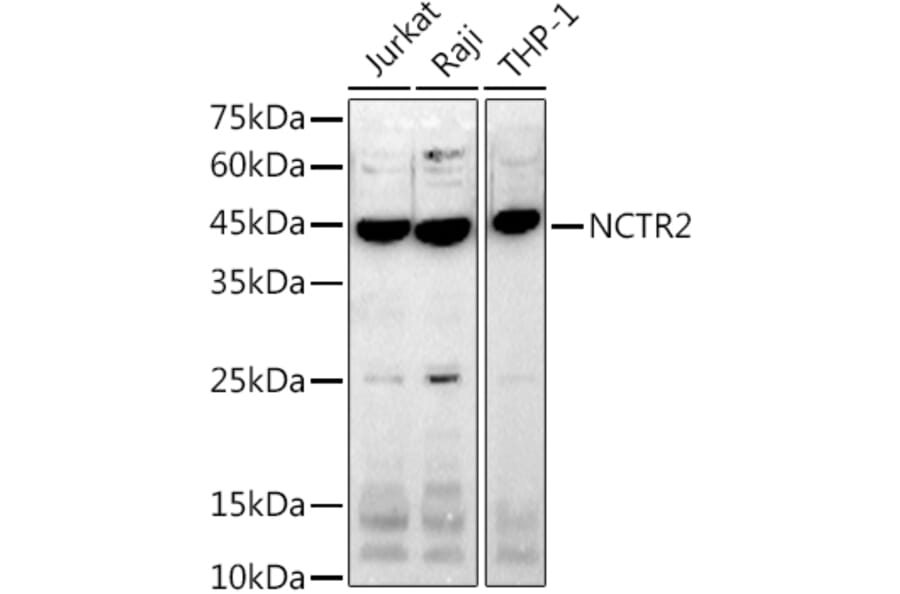 Western Blot - Anti-NK-p44 Antibody [ARC2719] (A307091) - Antibodies.com