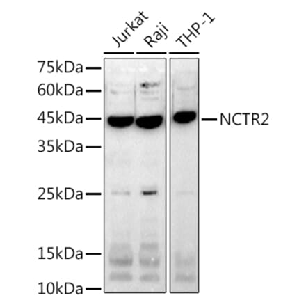 Western Blot - Anti-NK-p44 Antibody [ARC2719] (A307091) - Antibodies.com