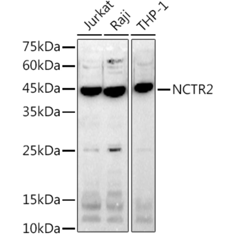 Western Blot - Anti-NK-p44 Antibody [ARC2719] (A307091) - Antibodies.com