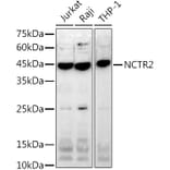 Western Blot - Anti-NK-p44 Antibody [ARC2719] (A307091) - Antibodies.com
