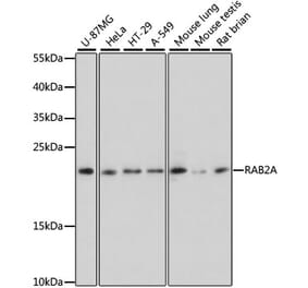 Western Blot - Anti-Rab2 Antibody (A307092) - Antibodies.com