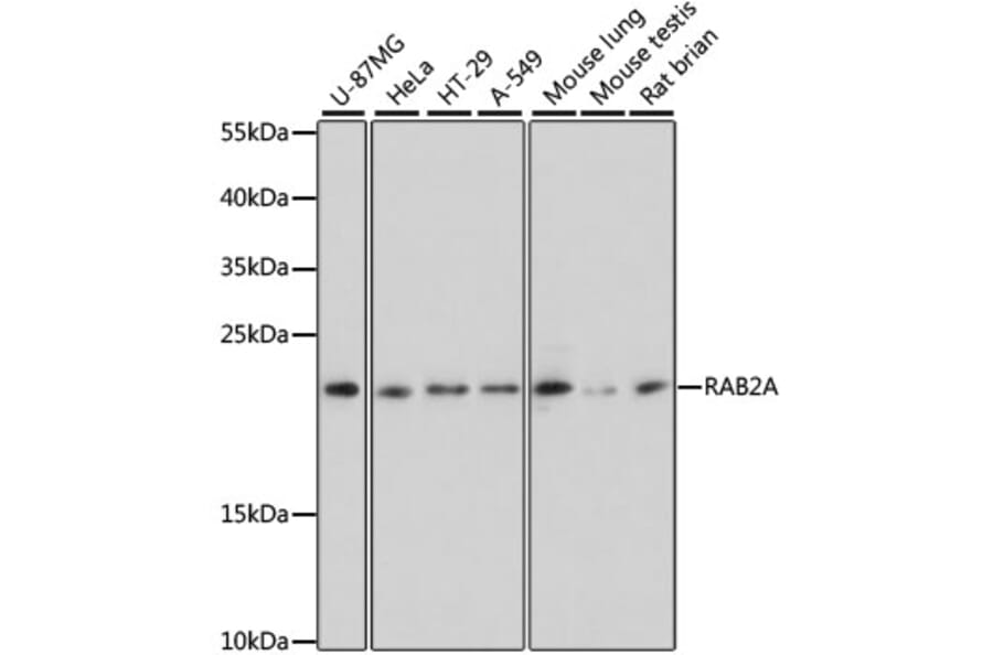 Western Blot - Anti-Rab2 Antibody (A307092) - Antibodies.com