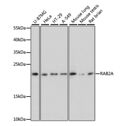 Western Blot - Anti-Rab2 Antibody (A307092) - Antibodies.com