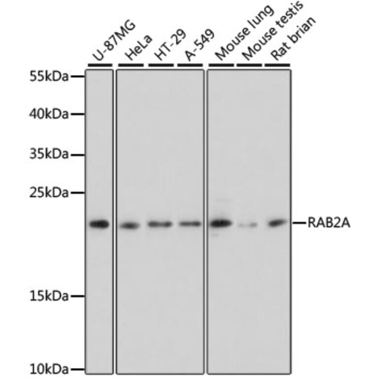 Western Blot - Anti-Rab2 Antibody (A307092) - Antibodies.com