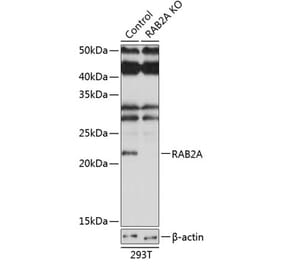 Western Blot - Anti-Rab2 Antibody (A307093) - Antibodies.com
