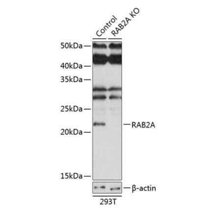 Western Blot - Anti-Rab2 Antibody (A307093) - Antibodies.com