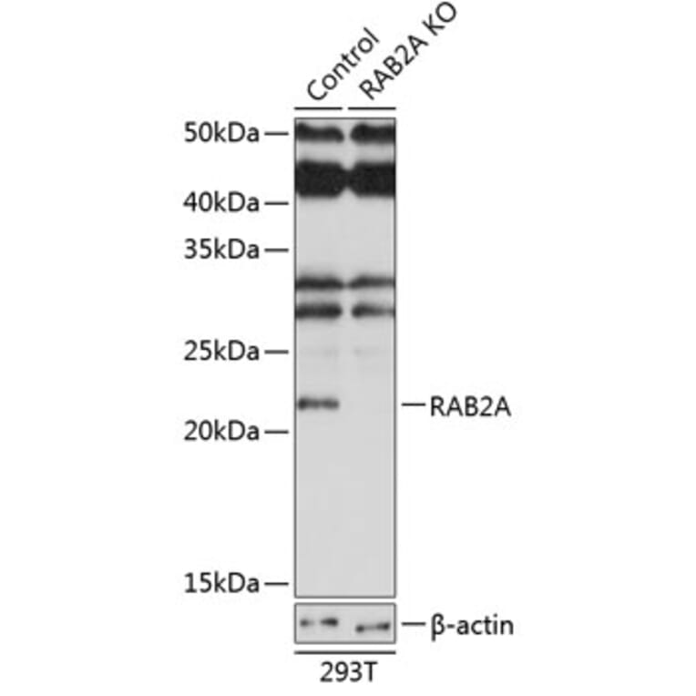 Western Blot - Anti-Rab2 Antibody (A307093) - Antibodies.com